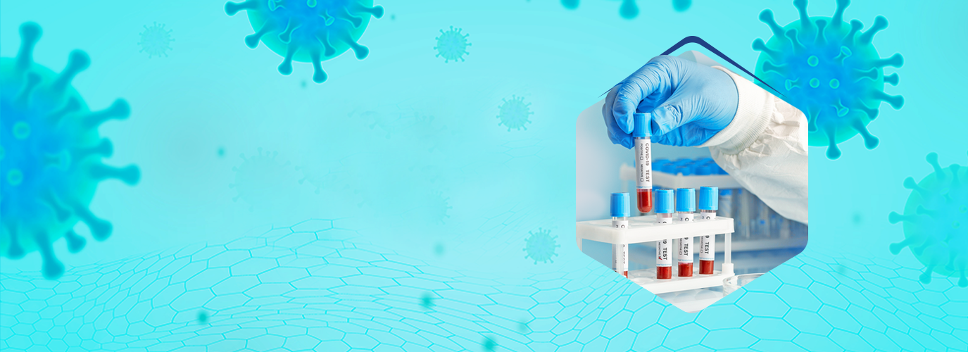 Covid-19 Antibody Test